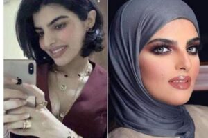 صور سارة الودعاني قبل وبعد عملية التجميل