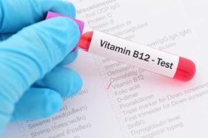 كم نسبة فيتامين B12 الطبيعي