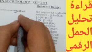 ما هو تحليل هرمون الحمل وكم تكون نسبة هرمون الحمل في أول أسبوع