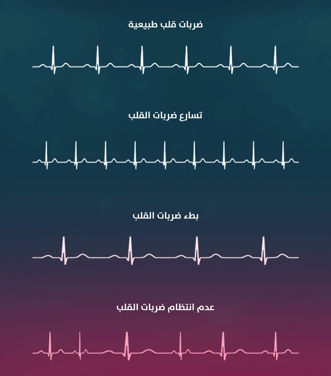 أفضل علاج لعدم انتظام ضربات القلب